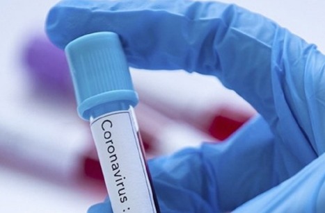 Подробнее о статье Как лечиться от коронавируса